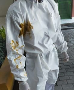 Wanita yang Lumurkan Kotoran Ke Satgas Covid-19 Jadi Tersangka