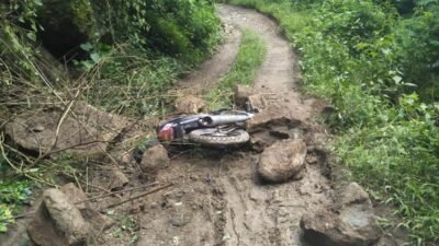 Akibat Tertimpa Batu Besar, Pelajar di Manggarai Mengalami Patah Tulang