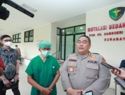 Biddokes Polda Jatim Gelar Operasi Hidrosefalus Peringati HUT Bhayangkara ke 76