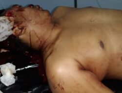 Luka Parah, Personel TNI Dikeroyok Sejumlah Anggota Ormas di Deli Serdang