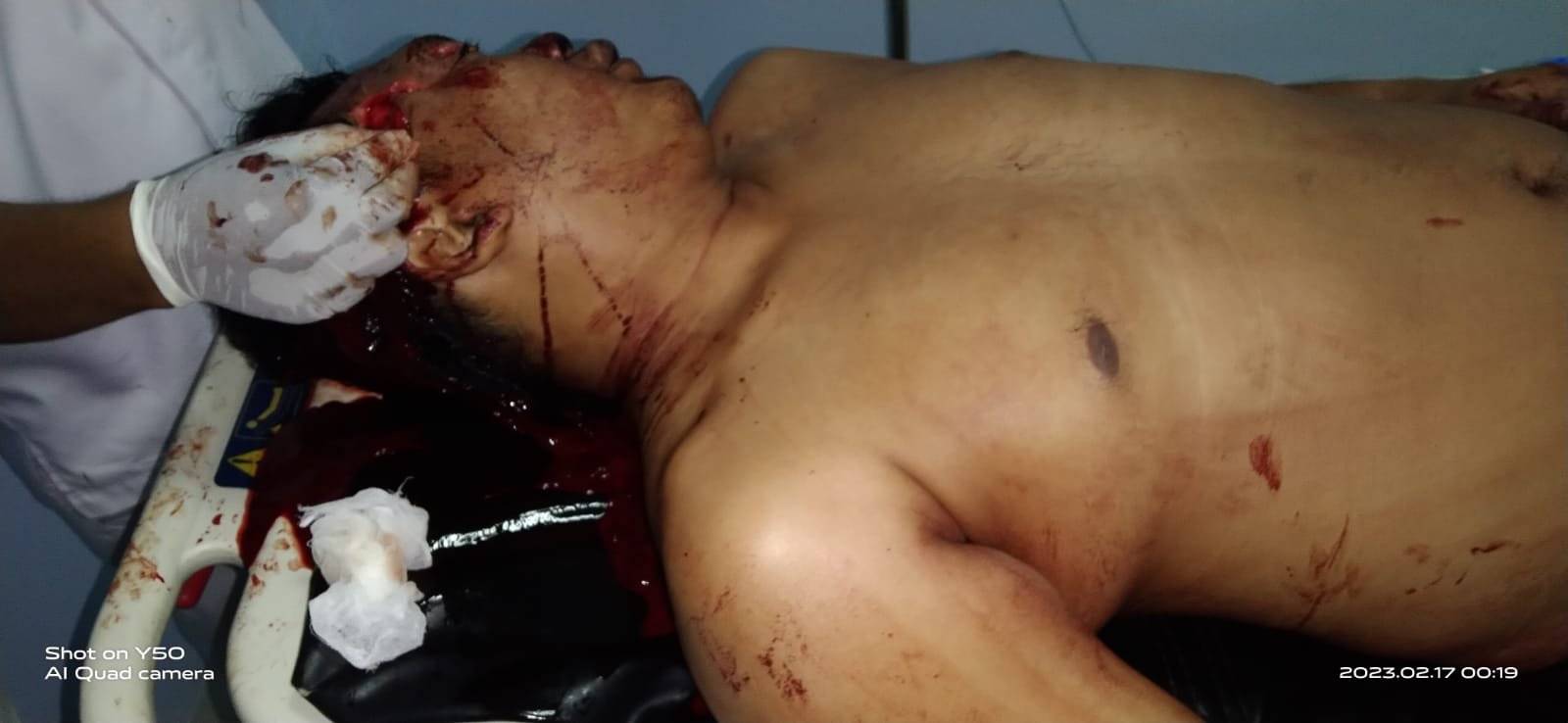 Luka Parah, Personel TNI Dikeroyok Sejumlah Anggota Ormas di Deli Serdang