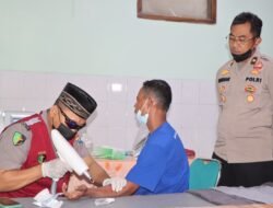 Layani Sepenuh Hati, Polres Nganjuk Gelar Program Operasi Hapus Tato Gratis
