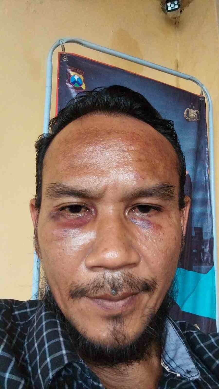 Dikeroyok Kepala Dusun Kebonagung Mojokerto, Korban Ajukan Syarat untuk Berdamai