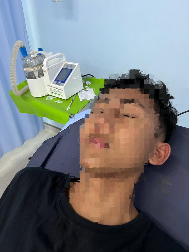 Anak Dibawah Umur Korban Pengeroyokan Oleh Unyil Adek Kandung Ketua DPRD Bangka Tengah