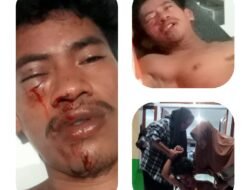 Merasa Tersinggung Karena Disebut Namanya Berulang Kali Oleh Bakri Warga Desa Bibinoi, Di Hajar Oleh Kades Beserta Kaur Hingga Babak Belur