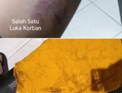 Istri Bersimbah Darah Alami 2 Kali KDRT, Polres Halmahera Selatan Bakal Tetapkan Kades Kaireu Sebagai Tersangka