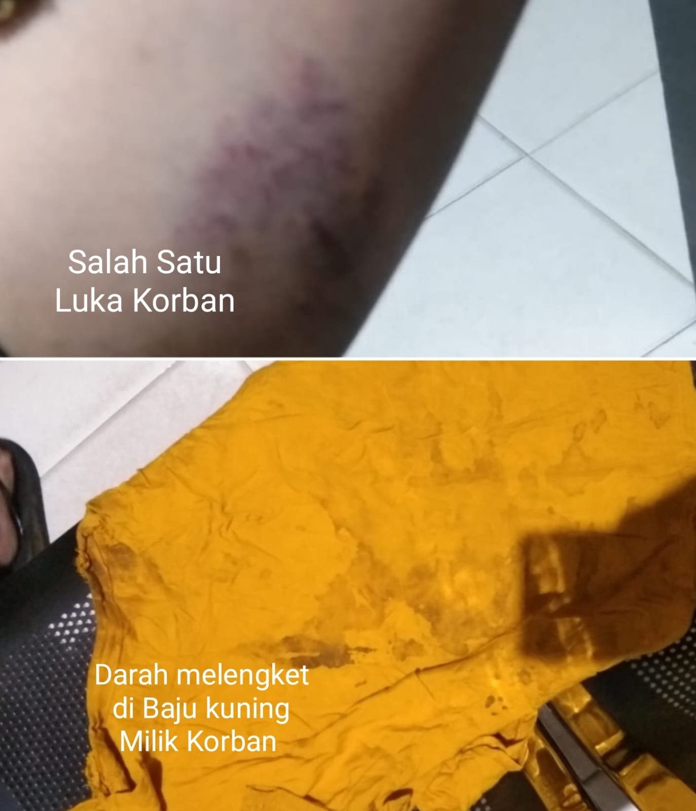 Istri Bersimbah Darah Alami 2 Kali KDRT, Polres Halmahera Selatan Bakal Tetapkan Kades Kaireu Sebagai Tersangka