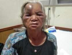 Supir Mobil Box Indomaret Hantam Betor Berpenumpang Seorang Nenek Masuk RSUD Adam Malik