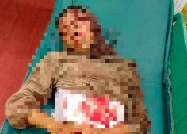 *HOAX! Viral Seorang Perempuan Jadi Korban Perampokan di Peureulak dan Idi Rayeuk, Ini Faktanya