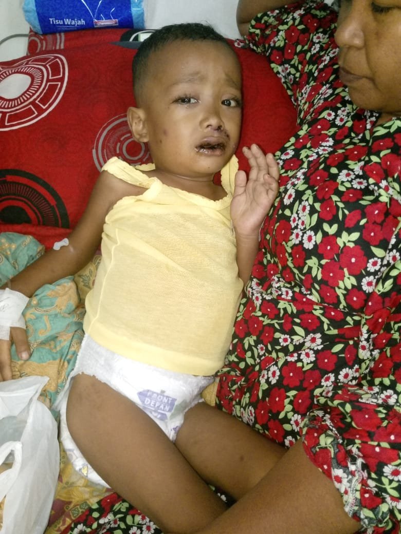 Al Karim Bocah 4 Tahun di Aceh Timur Didera Penyakit Bertubi-Tubi, Belum Dapat Bantuan