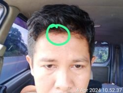 Korban Penganiayaan di SPBU SPBU 24-375-82 Desak Polres Tebo Segera Tangkap Pelakunya