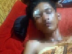 Diduga Curi Buah Sawit Oknum warga Simp Rantau Gedang Aniaya warga tebing tinggi Hingga Babak Belur