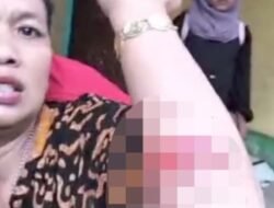 Hanya Gegara Minta Uang Tidak Dikasih, Anak Tega Lukai Ibu Kandung Dengan Sajam