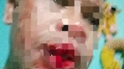 Keluarga Pelaku Aniaya Ongky Nyong Diingatkan Tak Lintasi Jalur Babang, Polisi Bergerak