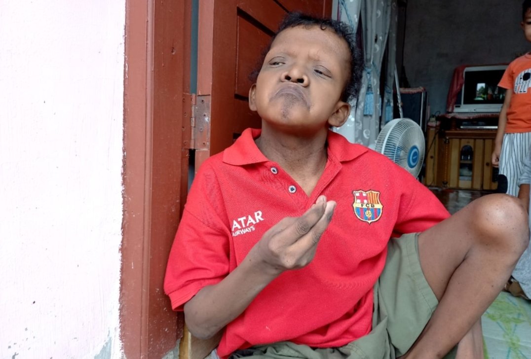 Seorang Warga Disabilitas di Desa Gempong Aceh Butuh Bantuan dari Pemerintah dan Dermawan