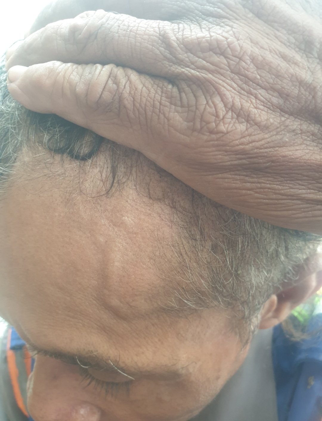 Relawan Zaenal Diduga Dianiaya, Sakty Law Surabaya Tegaskan Tidak Ada Kata Damai