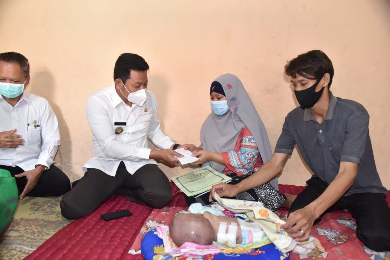 Pemkab Sidoarjo Fasilitasi Pengobatan Bayi Nayla Penderita Hidrosefalus dan Spina Bifida