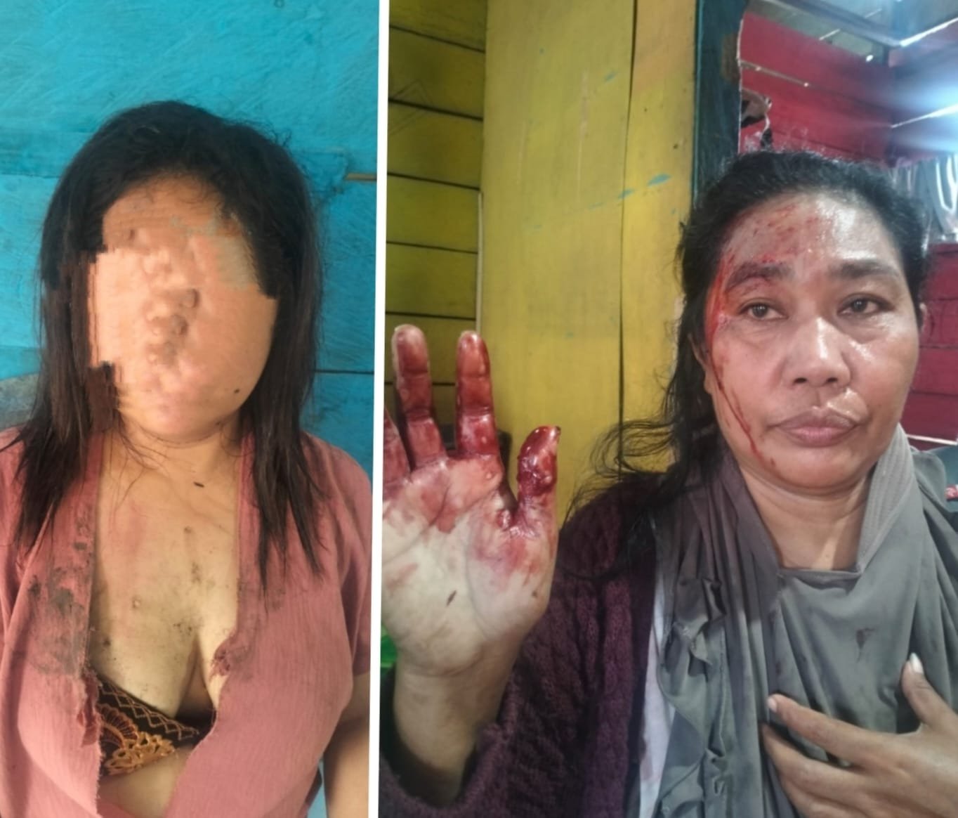 Kapolsek Laiwui Harus Diganti, Dua IRT di Obi Mandi Darah Pelaku Tidak Ditahan.