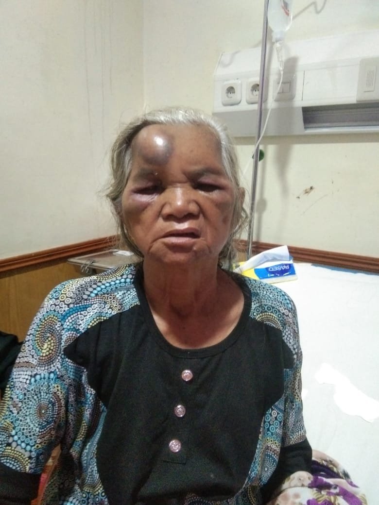 Supir Mobil Box Indomaret Hantam Betor Berpenumpang Seorang Nenek Masuk RSUD Adam Malik