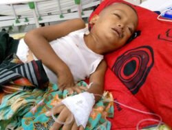 Al Karim Bocah 4 Tahun di Aceh Timur Didera Penyakit Bertubi-Tubi, Belum Dapat Bantuan